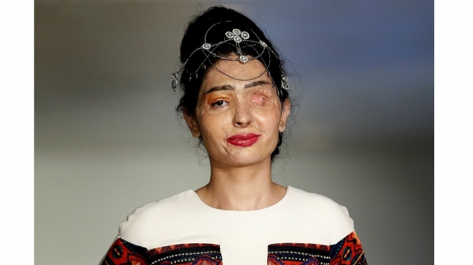 Reshma Quereshi perdeu um olho e sofreu graves queimaduras