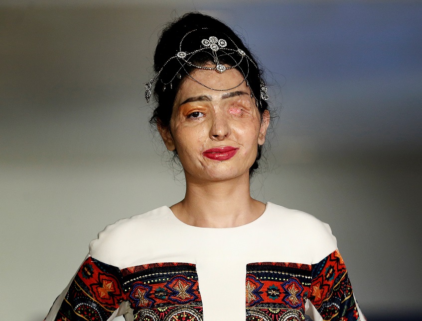 Reshma Quereshi perdeu um olho e sofreu graves queimaduras