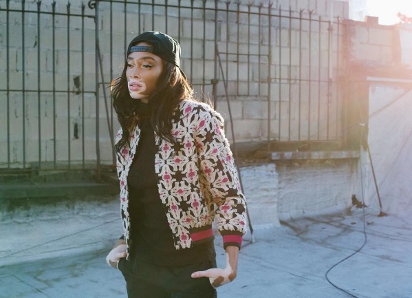 Winnie Harlow é canadiana e tem 22 anos