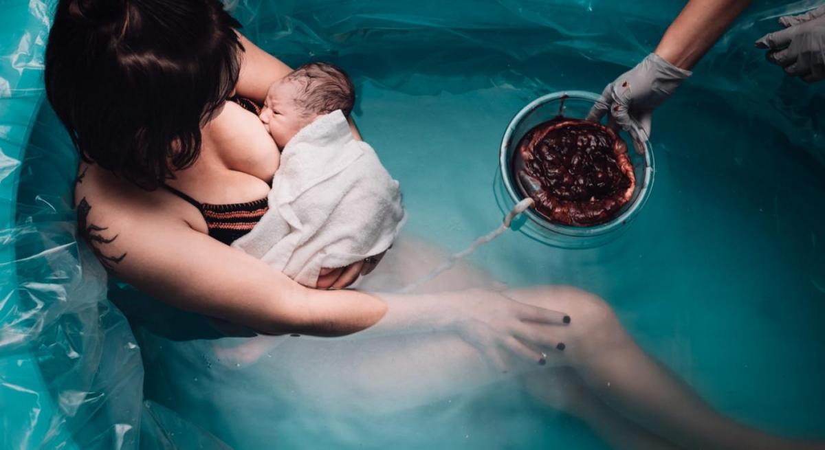 As imagens brutais de um concurso de fotos de partos