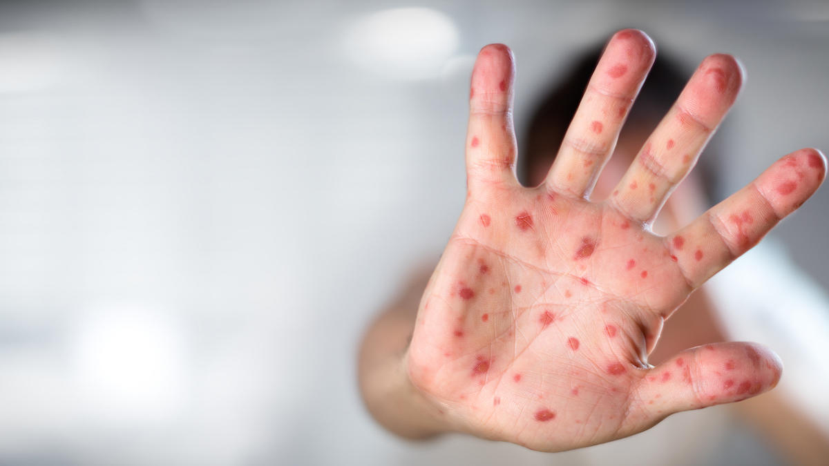 shutterstock_550598923