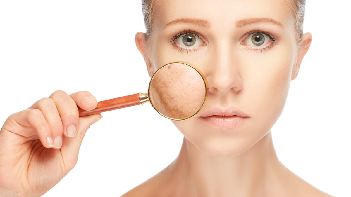 shutterstock_pele_manchas