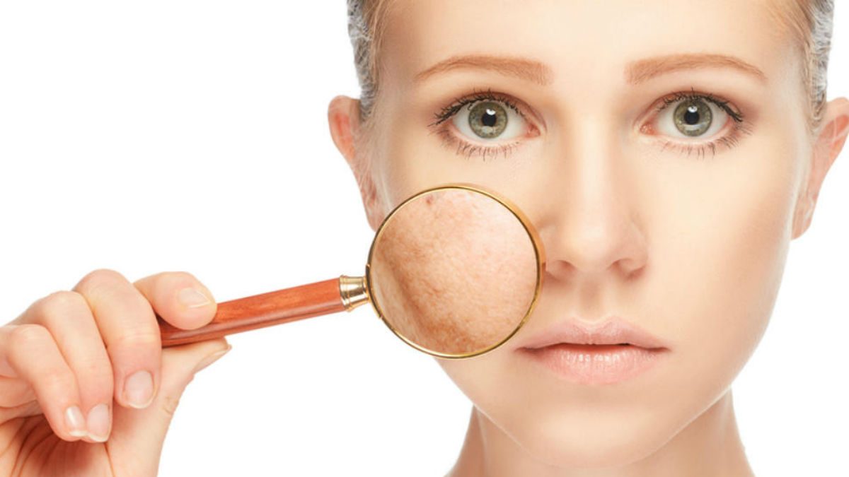 shutterstock_pele_manchas