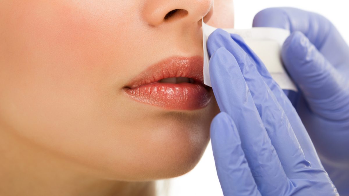 woman reciving facial epilation