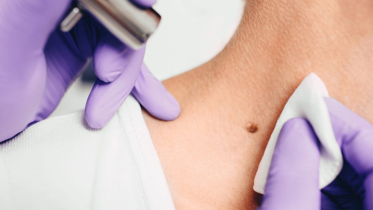 iStock-1130732676 (1)