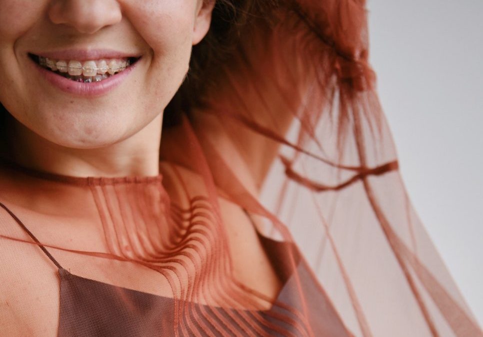 aparelho pexels-anastasia-onegina-4820432