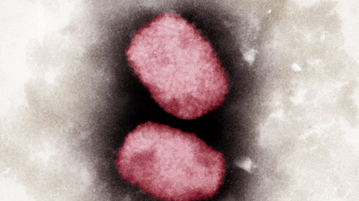 GERMANY-UN-HEALTH-VIRUS-MONKEYPOX