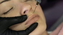 botox ácido Hialurónico Julio Matias soceidade portuguesa