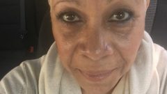 denise Dowse coma meningute viral Anatomia de Grey atriz