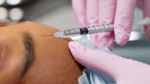 botox tratametnpos estéticos