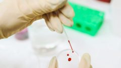 amostra sangue cancro