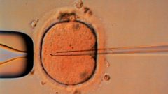 infertilidade afeta 1 em cada seis OMS estudo relatório