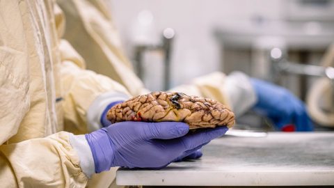 cérebro investigação células