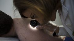 cancro de pele vacina