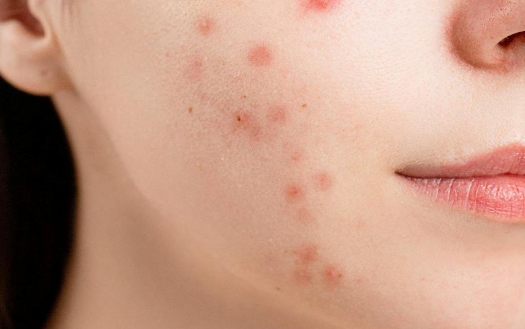 pexels-anna-nekrashevich-6475987