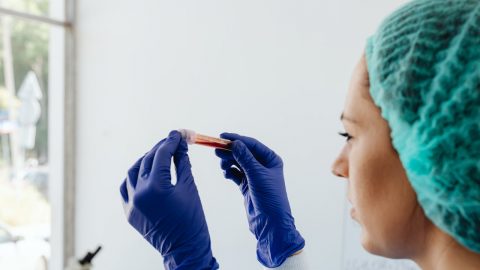 Doença lupus sangue reverter