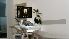 análises clínicas ecografias raio-X greve técnicos superiores de diagnóstico quatro dias